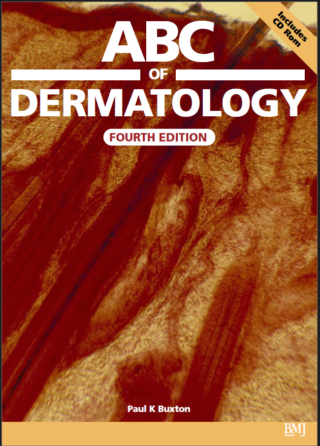 ABC of Dermatology